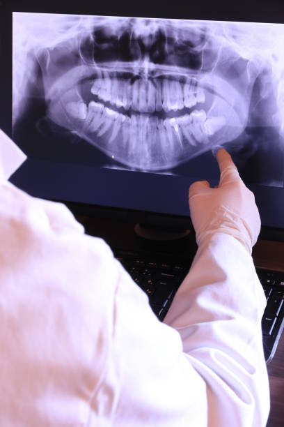 Professional Emergency Dental Service in CA
